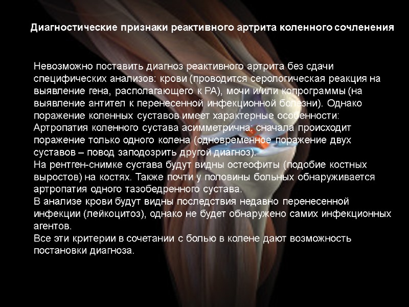 Диагностические признаки реактивного артрита коленного сочленения Невозможно поставить диагноз реактивного артрита без сдачи специфических